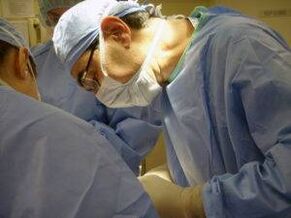 An operation to increase the member